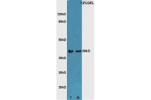 Lane 1:Mouse embryo lysate Lane 2:Mouse eye lysate probed with Rabbit Anti-ATF4/CREB-2 Polyclonal Antibody, Unconjugated  at 1:5000 for 90 min at 37˚C. (ATF4 抗体  (AA 251-351))