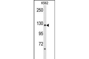 Phospholipase C beta 2 antibody  (N-Term)