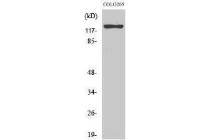 Western Blotting (WB) image for anti-Suppression of Tumorigenicity 5 (ST5) (Internal Region) antibody (ABIN3177531) (ST5 抗体  (Internal Region))