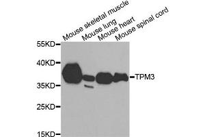 Western blot analysis of extracts of various tissues, using TPM3 antibody. (TPM3 抗体)