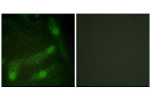 Immunofluorescence analysis of HeLa cells, using Smad2 (Phospho-Thr220) antibody. (SMAD2 抗体  (pThr220))