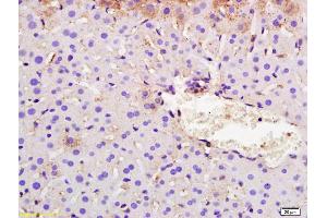 Formalin-fixed and paraffin embedded mouse liver labeled with Rabbit Anti SYVN1/HRD1 Polyclonal Antibody, Unconjugated (ABIN671811) at 1:200 followed by conjugation to the secondary antibody and DAB staining (SYVN1 抗体  (AA 531-617))
