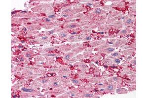 Anti-SCO1 antibody IHC of human heart. (SCO1 抗体  (Internal Region))