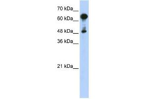WB Suggested Anti-HSPA6 Antibody Titration: 0. (HSPA6 抗体  (Middle Region))