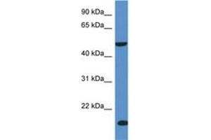 Image no. 1 for anti-Inositol Polyphosphate-5-Phosphatase K (INPP5K) (AA 244-293) antibody (ABIN6746948) (INPP5K 抗体  (AA 244-293))