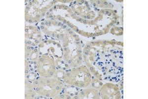 Immunohistochemistry of paraffin-embedded mouse kidney using CHMP1B antibody. (CHMP1B 抗体  (AA 1-199))