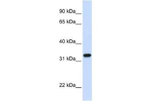 TBCB antibody used at 1 ug/ml to detect target protein. (TBCB 抗体  (C-Term))