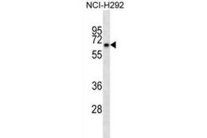 Western Blotting (WB) image for anti-Kelch-like protein 41 (KLHL41) antibody (ABIN2998754) (Kelch-like protein 41 (KLHL41) 抗体)
