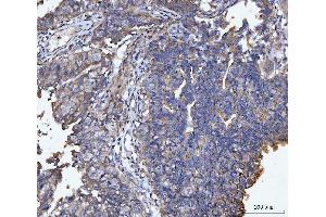 IHC analysis of MUC1 using anti-MUC1 antibody (ABIN7602711).
