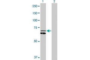 Western Blot analysis of HSPD1 expression in transfected 293T cell line by HSPD1 MaxPab polyclonal antibody. (HSPD1 抗体  (AA 1-573))