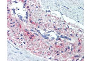 Anti-SSX4 antibody IHC of human vessel, smooth muscle.