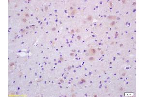 Formalin-fixed and paraffin embedded rat brain labeled with Rabbit Anti CDC37 Polyclonal Antibody, Unconjugated (ABIN706481) at 1:200 followed by conjugation to the secondary antibody and DAB staining (CDC37 抗体  (AA 291-378))