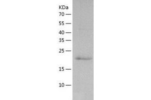 Western Blotting (WB) image for Vacuolar Protein-Sorting-Associated Protein 25 (VPS25) (AA 1-200) protein (His tag) (ABIN7125692) (VPS25 Protein (AA 1-200) (His tag))