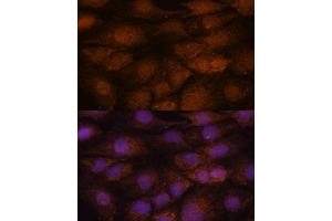 Immunofluorescence analysis of C6 cells using CEP85 antibody (ABIN7266281) at dilution of 1:100. (CEP85 抗体  (AA 130-430))