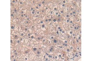 Used in DAB staining on fromalin fixed paraffin- embedded liver tissue (CD5 抗体  (AA 25-372))