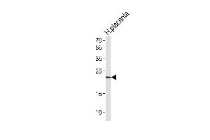 Western blot analysis of lysate from human placenta tissue lysate,using HES2 Antibody was diluted at 1:1000. (HES2 抗体)
