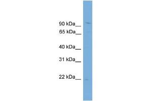 WB Suggested Anti-TPPP3 Antibody Titration:  0. (TPPP3 抗体  (N-Term))