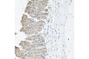 Immunohistochemistry of paraffin-embedded mouse stomach using ATP1B1 antibody at dilution of 1:100 (x40 lens). (ATP1B1 抗体)
