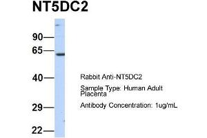 Host:  Rabbit  Target Name:  NT5DC2  Sample Type:  Human Adult Placenta  Antibody Dilution:  1. (NT5DC2 抗体  (N-Term))