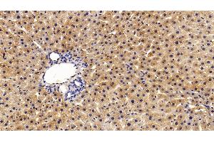 Immunohistochemistry (IHC) image for anti-Alanine Aminotransferase (ALT) (AA 367-480) antibody (ABIN7429409)