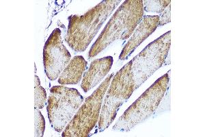 Immunohistochemistry of paraffin-embedded rat testis using CD47 Rabbit pAb (ABIN3022623, ABIN3022624, ABIN3022625, ABIN1512716 and ABIN6218964) at dilution of 1:100 (40x lens).