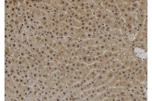 ABIN6272533 at 1/100 staining Rat liver tissue by IHC-P. (ZNF839 抗体  (Internal Region))