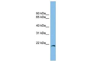 WB Suggested Anti-CIRBP Antibody Titration: 0. (CIRBP 抗体  (Middle Region))