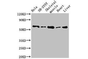 Western Blot Positive WB detected in: Hela whole cell lysate, SH-SY5Y whole cell lysate, Mouse skeletal muscle tissue, Rat heart tissue, Rat liver tissue All lanes: ASNS antibody at 2. (Asparagine Synthetase 抗体  (AA 364-551))