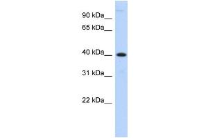 WB Suggested Anti-MPPE1 Antibody Titration:  0. (MPPE1 抗体  (N-Term))