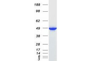 Western Blotting (WB) image for Protein Phosphatase Methylesterase 1 (PPME1) protein (Myc-DYKDDDDK Tag) (ABIN2729458)