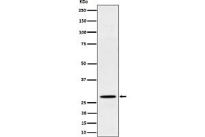 Western blot analysis of PSMB10 expression in Raji cell lysate.