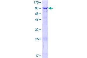 ACSF2 Protein (AA 1-615) (GST tag)