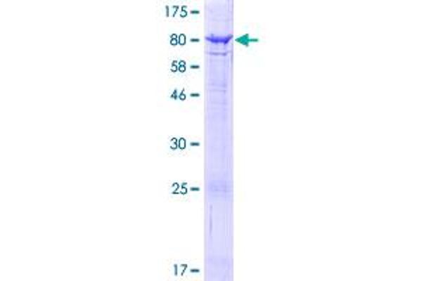 ACSF2 Protein (AA 1-615) (GST tag)