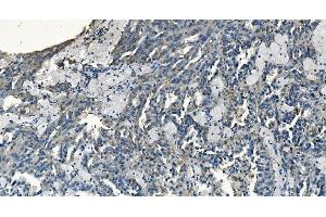 IHC analysis of GABARAP using anti-GABARAP antibody (ABIN7603159). (GABARAP 抗体  (N-Term))