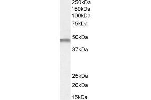Western Blotting (WB) image for anti-Phenylalanine Hydroxylase (Internal Region) antibody (ABIN571236)