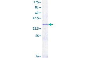 Image no. 1 for Fms-Related tyrosine Kinase 1 (VEGFR1) (FLT1) (AA 581-687) protein (GST tag) (ABIN1354218)