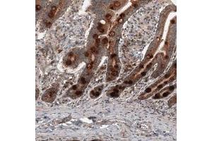 Immunohistochemical staining (Formalin-fixed paraffin-embedded sections) of human duodenum shows strong cytoplasmic immunoreactivity in glandular cells. (RBCK1 抗体)