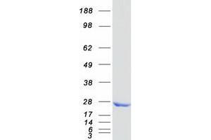 Western Blotting (WB) image for Ethylmalonic Encephalopathy 1 (ETHE1) protein (Myc-DYKDDDDK Tag) (ABIN2720574)