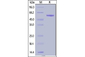 Human Complement Factor D, Fc Tag on  under reducing (R) condition. (Adipsin Protein (AA 26-253) (Fc Tag))