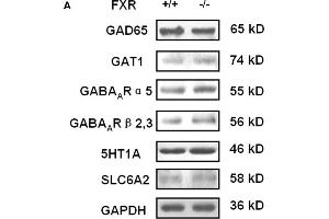 Western Blotting (WB) image for anti-Serotonin Receptor 1A (HTR1A) antibody (ABIN2855909)