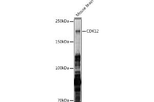 Western blot analysis of extracts of Mouse brain, using CDK12 antibody (ABIN7266230) at 1:1000 dilution. (CDK12 抗体  (AA 80-290))