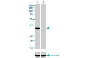 Western blot analysis of ITPK1 over-expressed 293 cell line, cotransfected with ITPK1 Validated Chimera RNAi (Lane 2) or non-transfected control (Lane 1). (ITPK1 抗体  (AA 1-314))