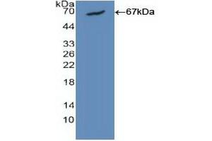 Detection of Recombinant CALM1, Human using Polyclonal Antibody to Calmodulin 1 (CALM1) (Calmodulin 1 抗体  (AA 1-149))
