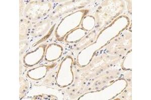 Immunohistochemistry analysis of paraffin-embedded human kidney using,THEA (ABIN7072933) at dilution of 1: 1600 (ACOT11 抗体)