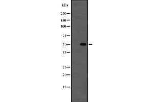 Western blot analysis of beta I Tubulin using K562 whole cell lysates (TUBB1 抗体)