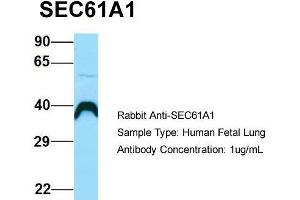 Host: Rabbit  Target Name: SEC61A1  Sample Tissue: Human Fetal Lung  Antibody Dilution: 1. (SEC61A1 抗体  (C-Term))
