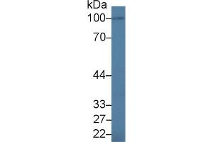 Western blot analysis of Human BXPC3 cell lysate, using Human IL17RA Antibody (1. (IL17RA 抗体  (AA 377-534))