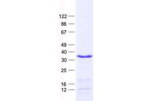 Validation with Western Blot (HOXD4 Protein (His tag))