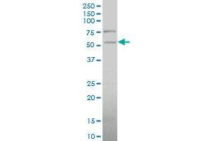 PDHX polyclonal antibody (A01), Lot # 051213JCO1 Western Blot analysis of PDHX expression in HepG2 . (PDHX 抗体  (AA 1-109))