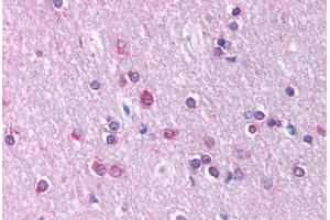 Human Brain, Cortex, White Matter (formalin-fixed, paraffin-embedded) stained with CLDN11 antibody ABIN214744 at 5 ug/ml followed by biotinylated goat anti-rabbit IgG secondary antibody ABIN481713, alkaline phosphatase-streptavidin and chromogen. (Claudin 11 抗体  (C-Term))